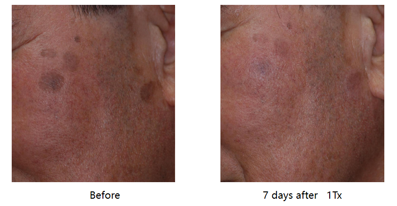 thulium4