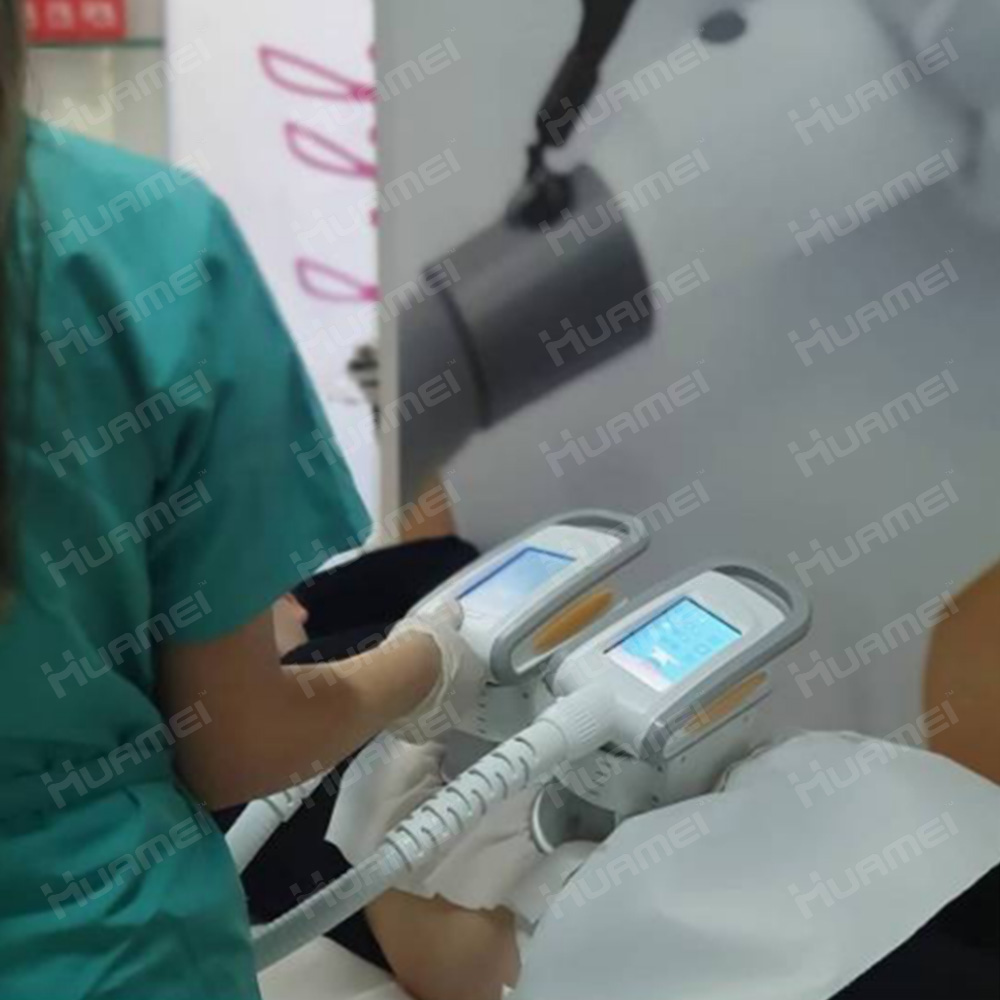 Cryo Fat Freeze for Fat Loss: Is It Safe?