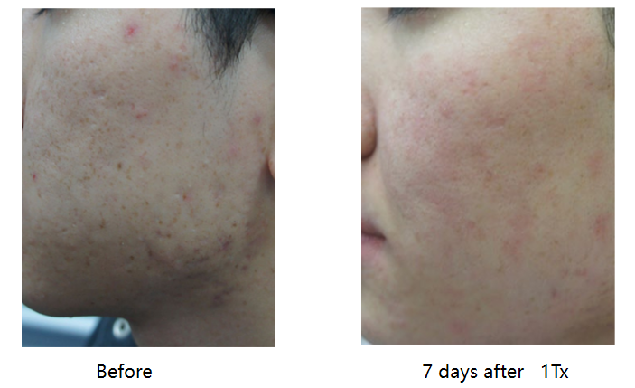 thulium3