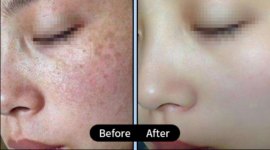 If you could only recommend one, which medical aesthetic procedure would you recommend?